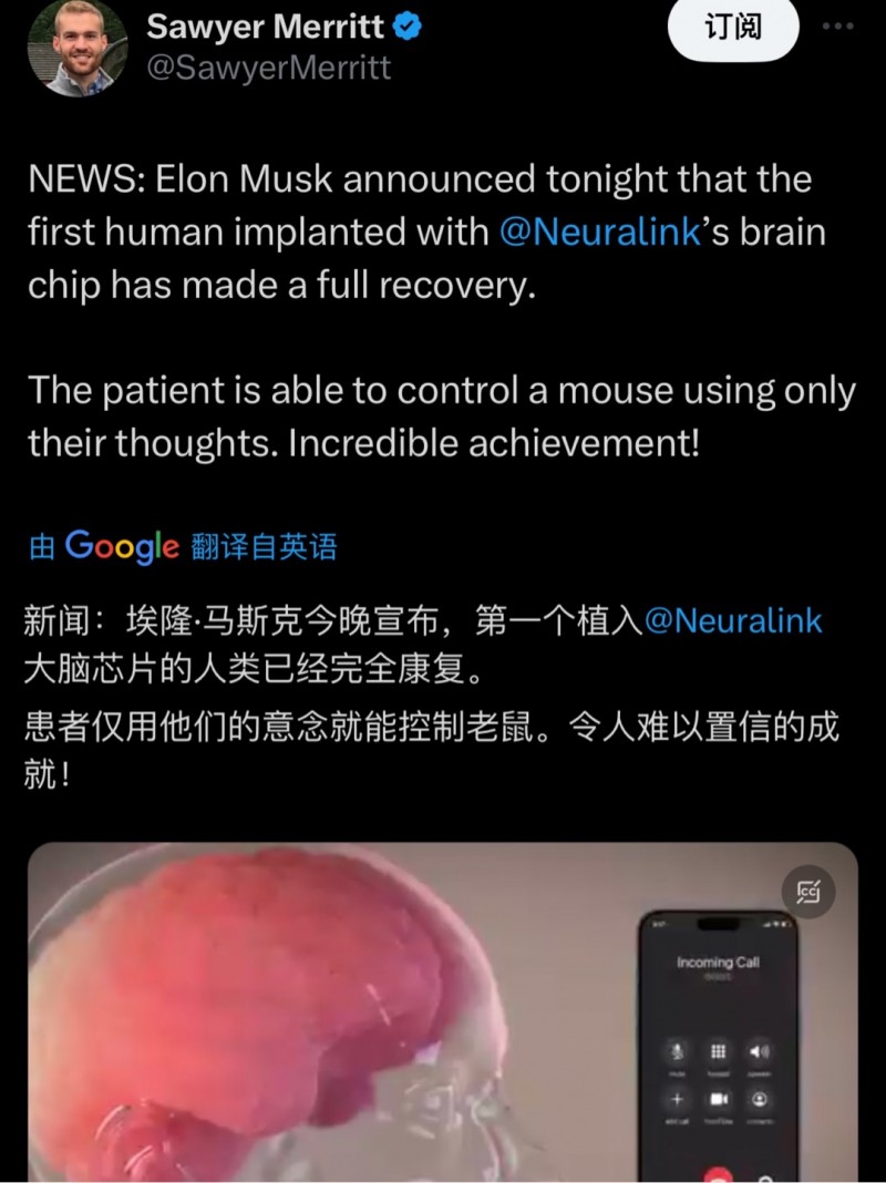 重大突破！首位脑机接口患者已完全恢复！可用思想控制鼠标！