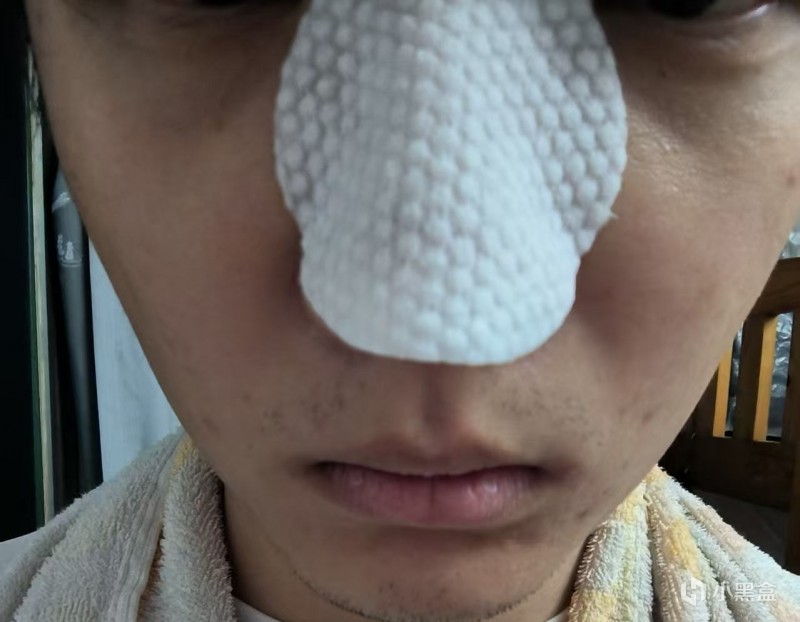 生活小贴士：鼻子上的黑头要怎么去掉？（亲身示范）
