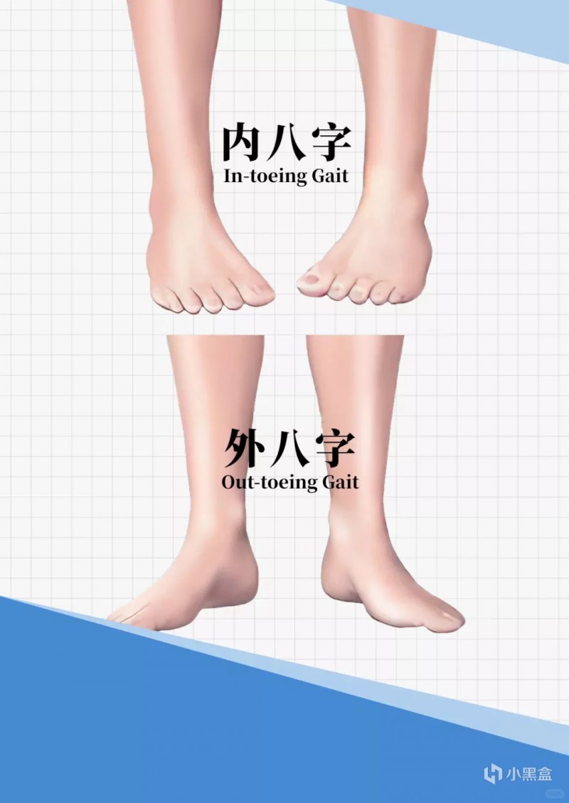 听说你走路外八字，就是跟别人走路挤别人的