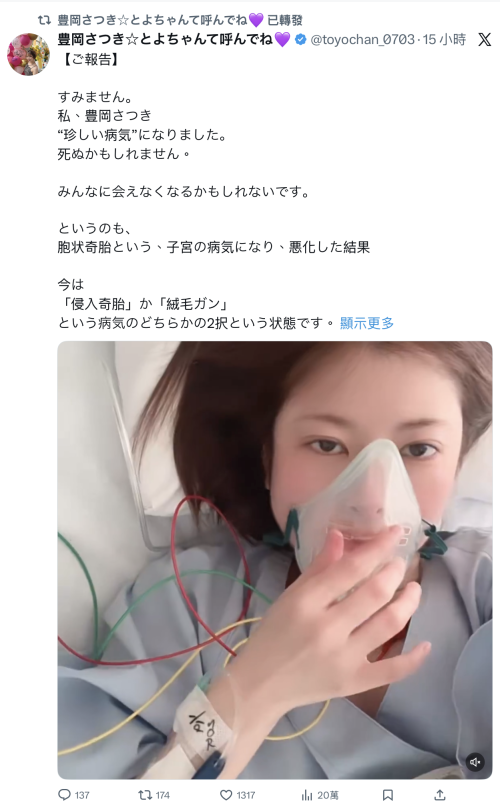 【球盟会】豊岡さつき(丰冈沙月)自爆罹患罕见疾病、可能致命！