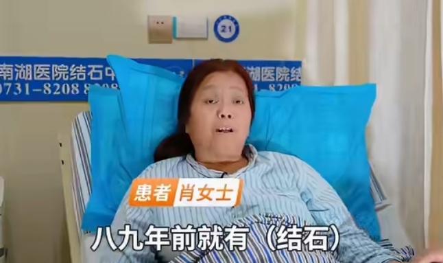 【球盟会】离谱！9年3000杯奶茶，肾脏被结石填满