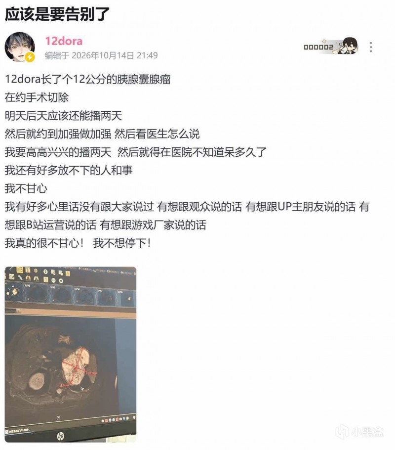 【球盟会】B站上古一哥12dora自曝患瘤 发告别文坦言不甘心